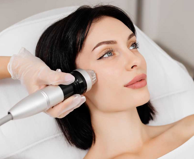 Microneedling - RF