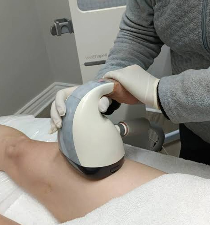 Velashape