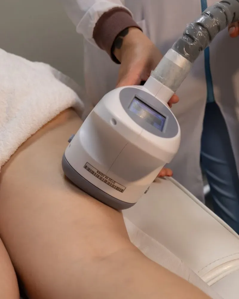 Velashape body contouring and cellulite reduction treatment