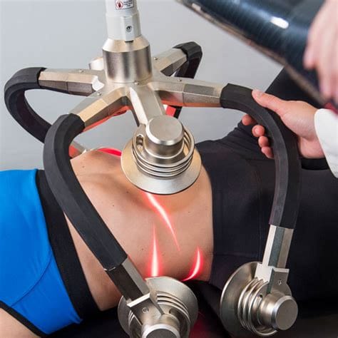Zerona Laser Treatment